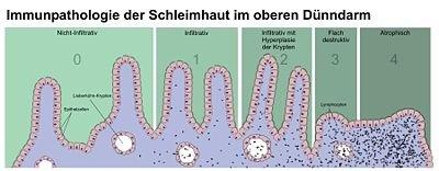 Immunpathologie der Schleimhaut im oberen Dünndarm